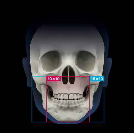 fov イメージ1